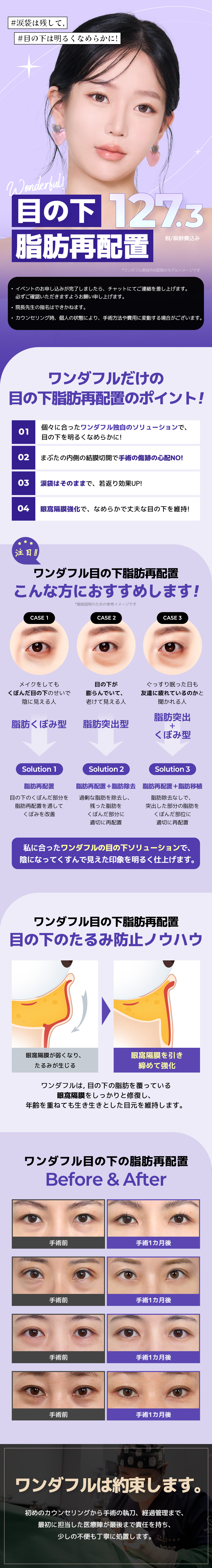 Phẫu thuật tái phân bổ mỡ dưới mắt | Giữ túi mắt tạo ấn tượng trẻ trung | Wonderful Gangnam Seoul