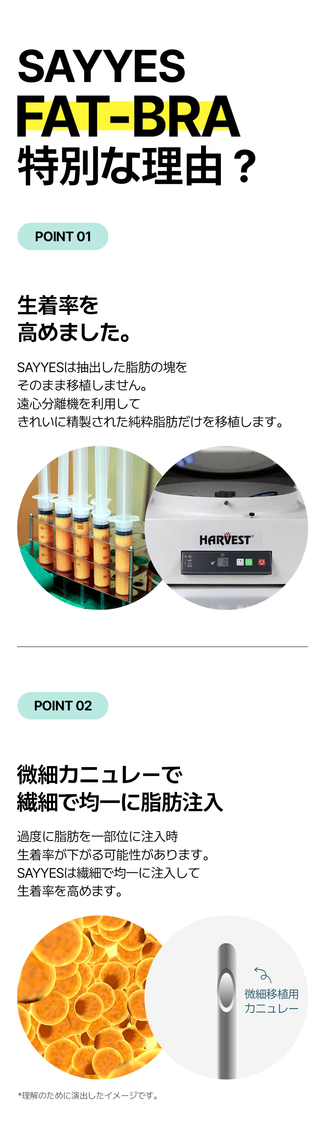 【Nâng ngực cấy mỡ】Fat Bra hướng đến nâng ngực tự nhiên | Say Yes Clinic Gangnam Hàn Quốc