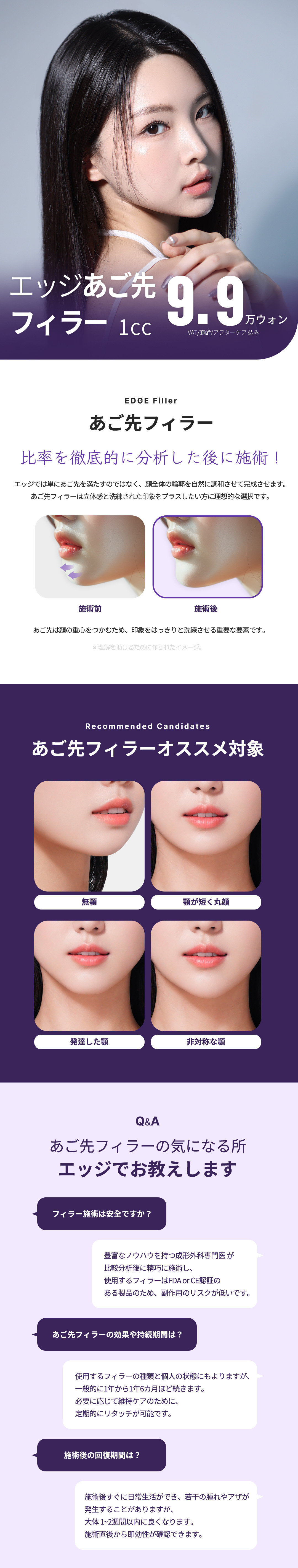 Điều trị filler đầu cằm Edge Thẩm mỹ viện Daegu | Hướng đến tạo đường viền tự nhiên với sản phẩm được FDA chứng nhận | Cách ga Banwoldang 2 phút đi bộ