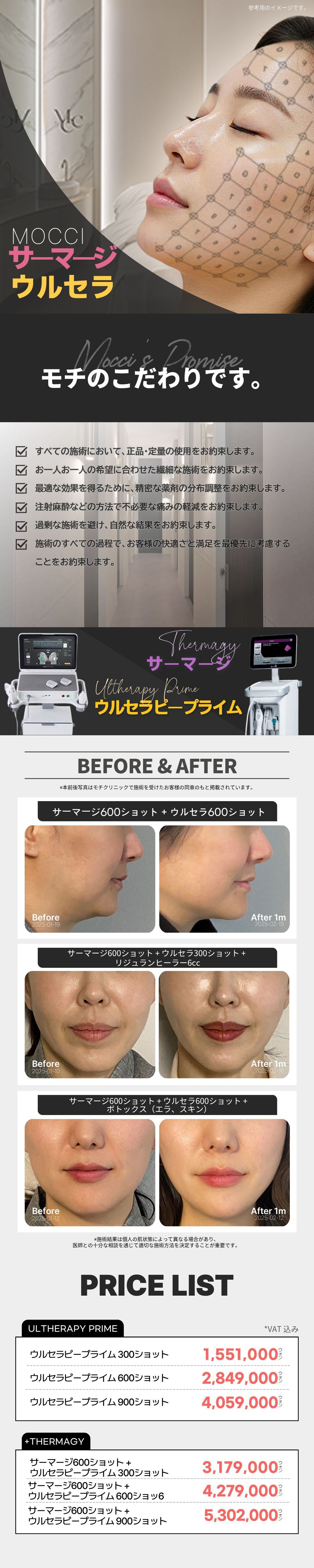 Nâng cơ Ulthera/Thermage FLX | Sử dụng sản phẩm chính hãng, chú trọng chăm sóc đau | Phòng khám Mochi ga Seoul Gangnam
