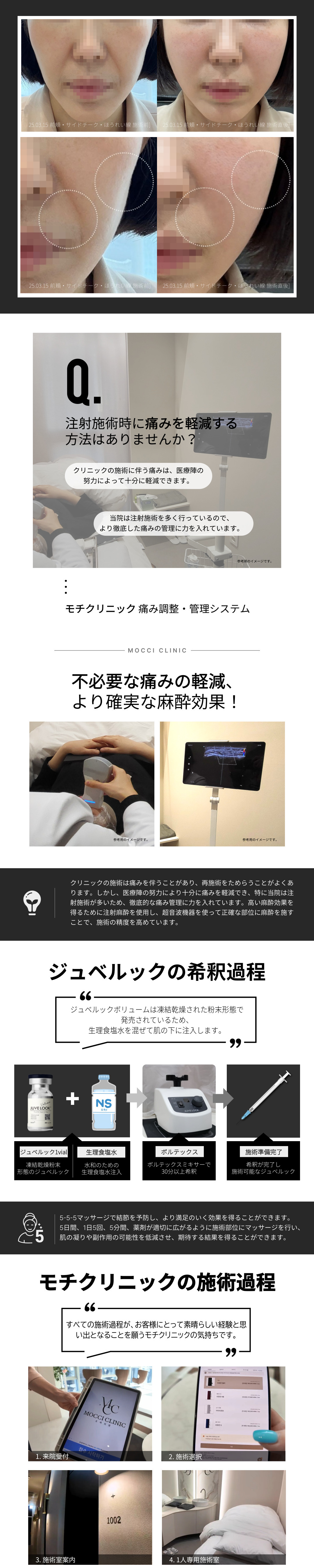 Đặc biệt Collagen Booster mang lại cảm giác căng mọng Sculptra, Ultra Call, Juvelook Volume