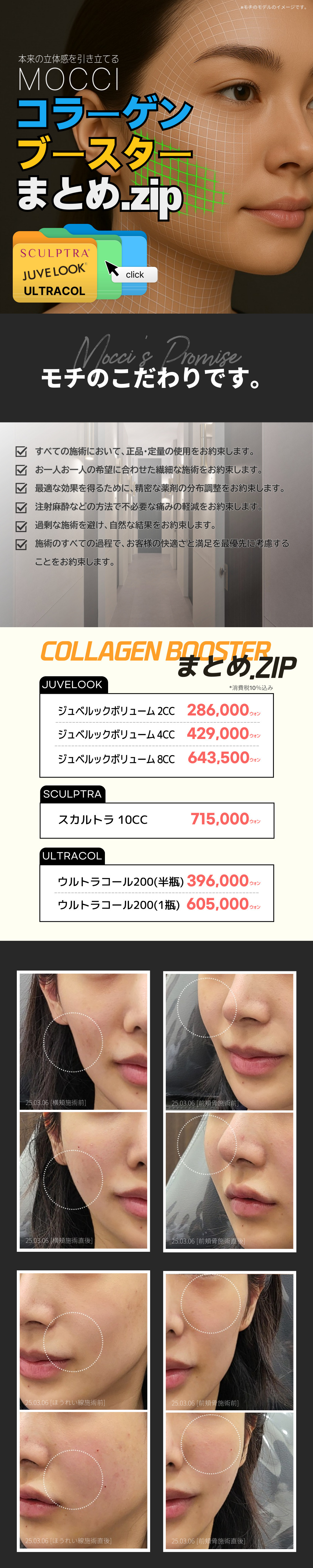 Đặc biệt Collagen Booster mang lại cảm giác căng mọng Sculptra, Ultra Call, Juvelook Volume