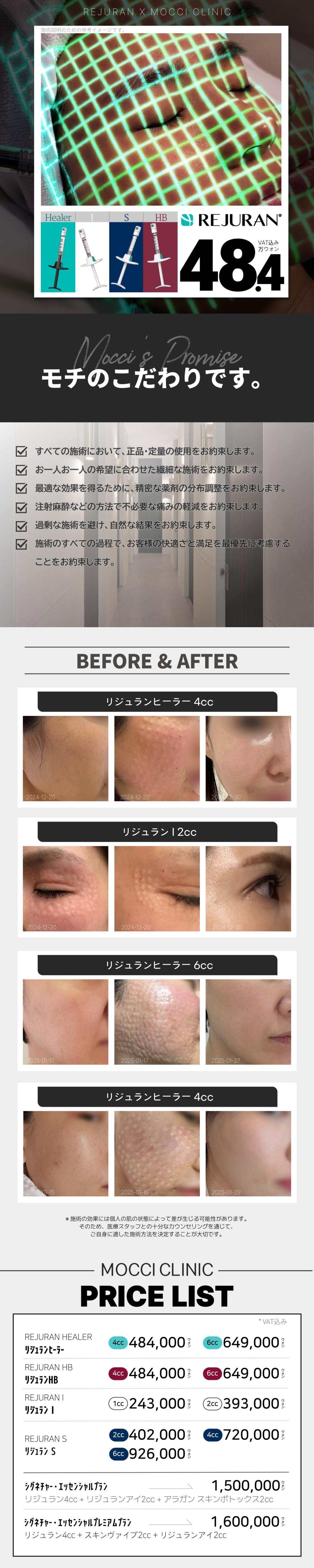 Tiêm Rejuran Healer | Hỗ trợ tái tạo da tinh tế bằng kỹ thuật tiêm tay | Mochi Clinic Gangnam