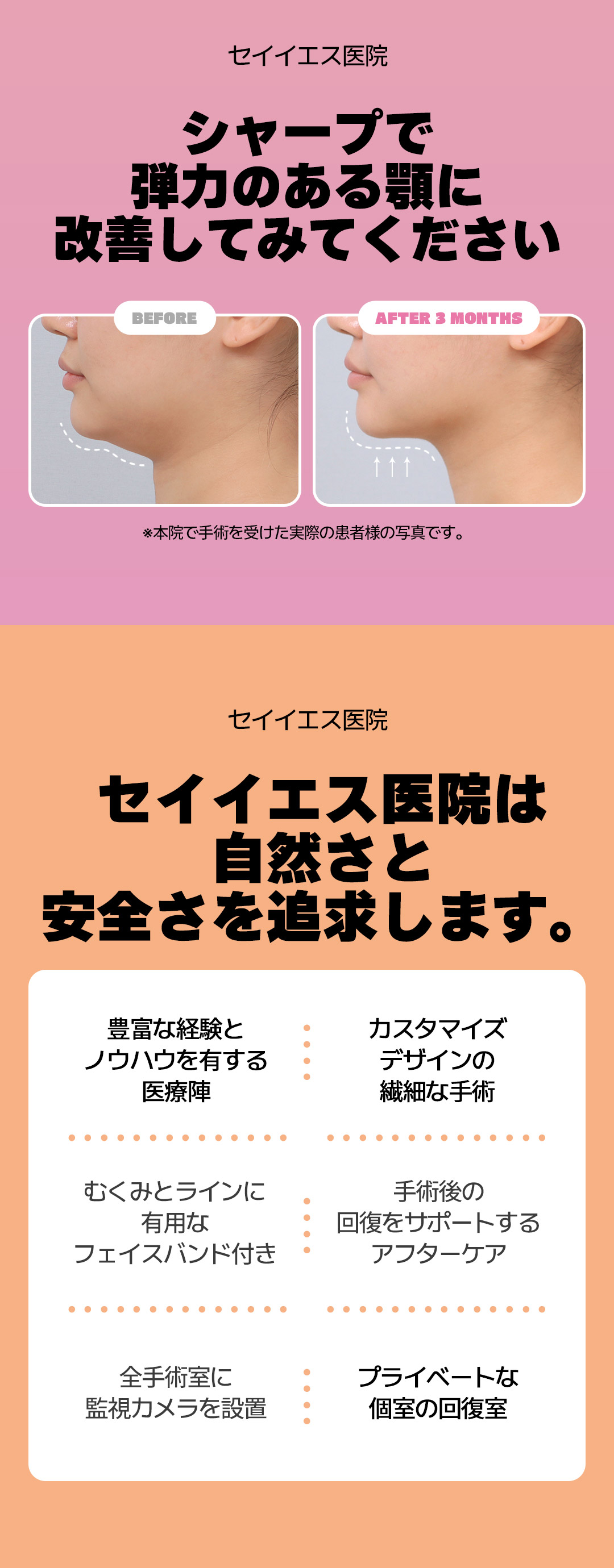 Hút mỡ mặt và phẫu thuật đường viền Accu V Say Yes Clinic Hàn Quốc | Mặt nhỏ, tạo V-line | Ga Sinnonhyeon Seoul
