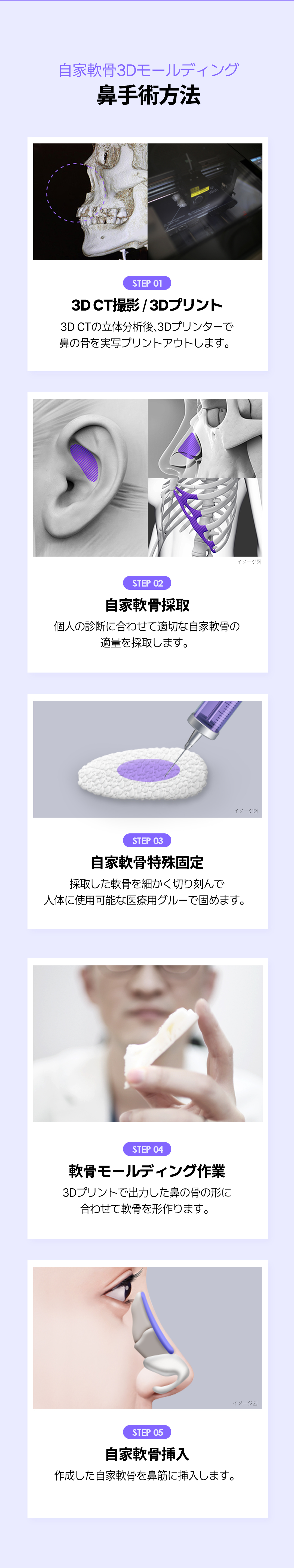 Nâng mũi tạo khuôn 3D sụn tự thân | Hướng tới kết quả tự nhiên không dùng túi độn | Lala Phẫu thuật Tạo hình Thẩm mỹ