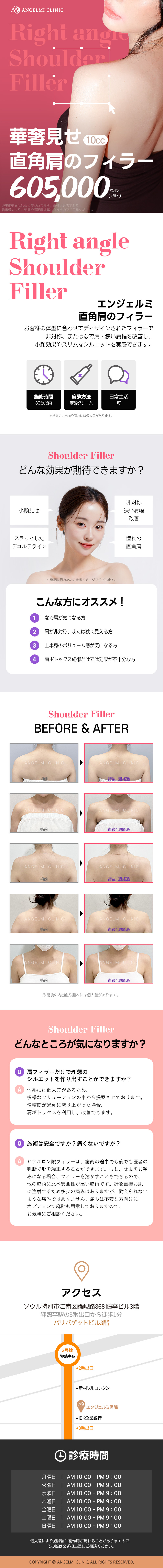 Filler vai hướng đến cải thiện vai xuôi｜Thủ thuật kỳ vọng hiệu quả vai vuông・mặt nhỏ｜Phòng khám Angel Mi ga Apgujeong