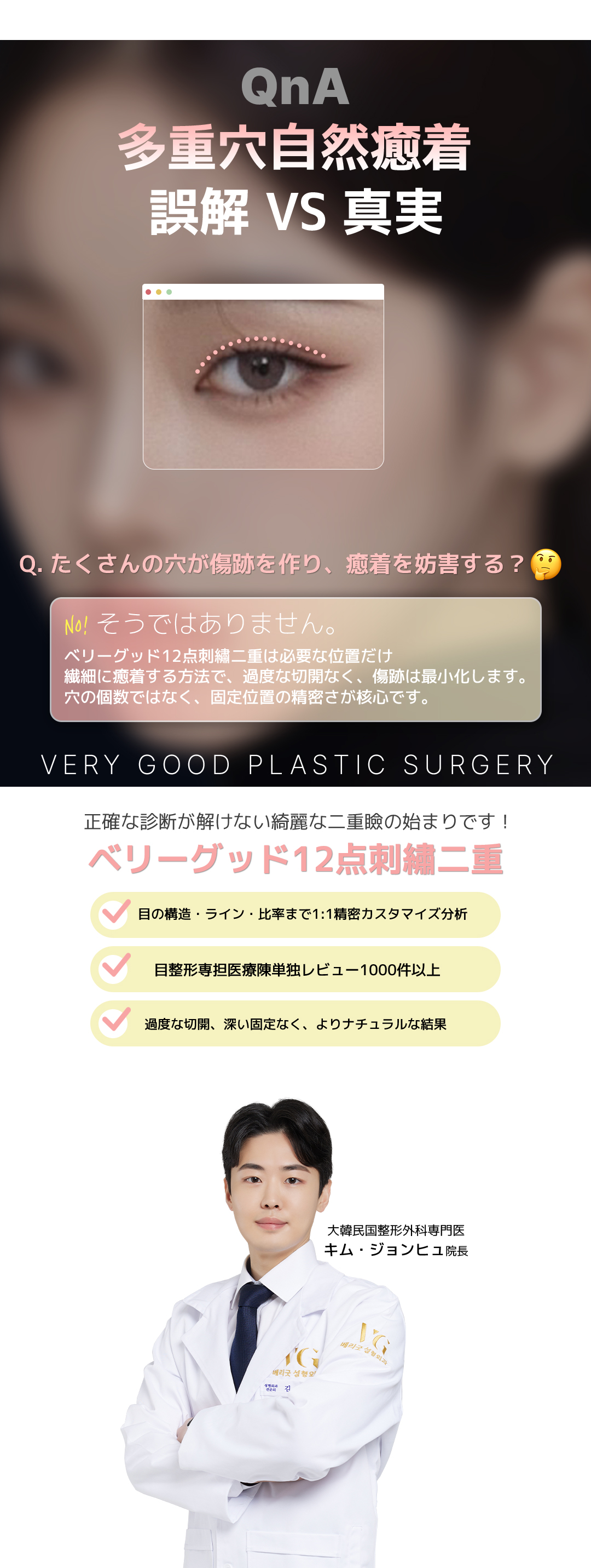 Mí đôi thêu 12 điểm của Verygood Thẩm mỹ ga Gangnam Hàn Quốc | Phương pháp bấm mí hướng tới đường nét tự nhiên với thiết kế tùy chỉnh 1:1