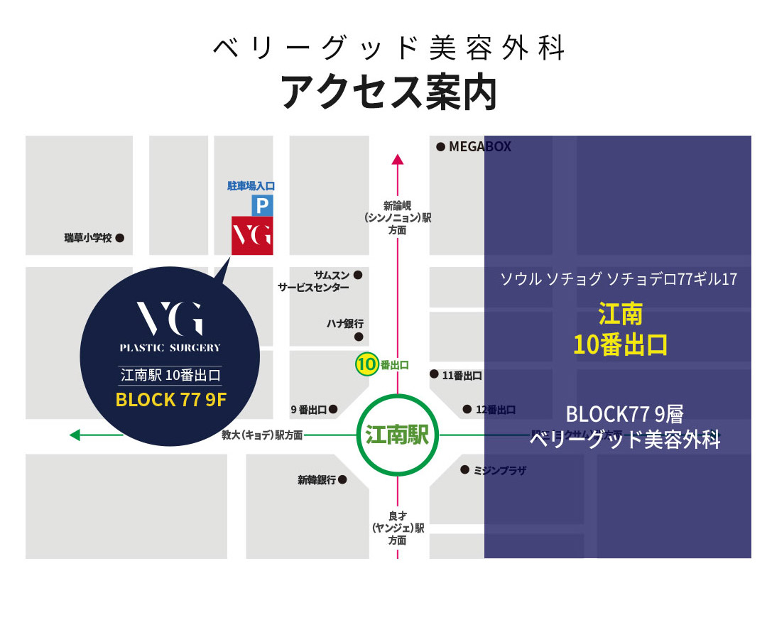 【Chỉ mô tự thân】Phẫu thuật mũi Mumu không có Verygood | Hướng tới kết quả tự nhiên không prosthesis | Verygood Thẩm mỹ ga Gangnam