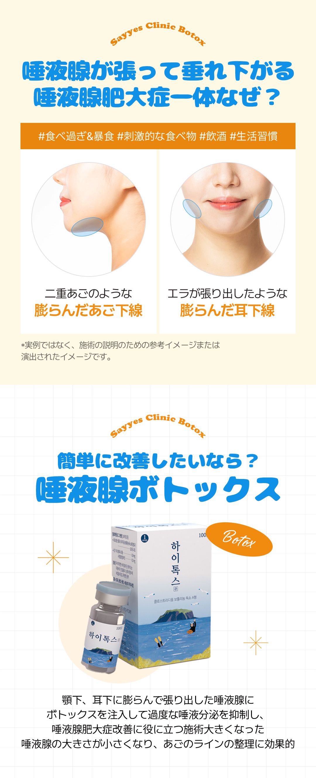 Botox tuyến nước bọt hướng đến khuôn mặt V-line｜Thủ thuật có thể mong đợi cải thiện hàm・nọng cằm｜Phòng khám Say Yes Gangnam Seoul