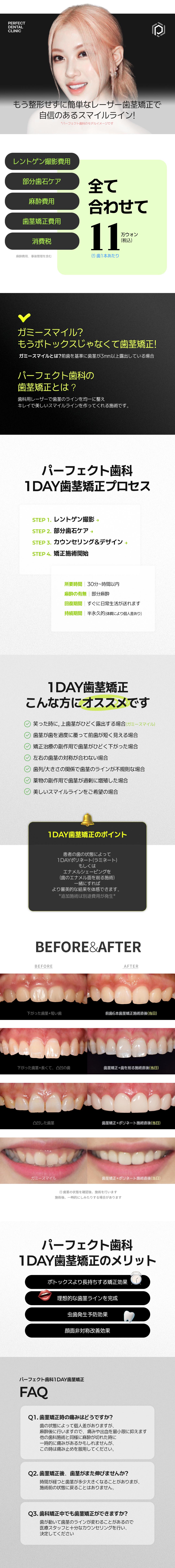 Cải thiện nụ cười hở lợi・Chỉnh đường viền nướu | Điều trị laser 1 ngày hướng tới đường cười lý tưởng | Gangnam Perfect Dental