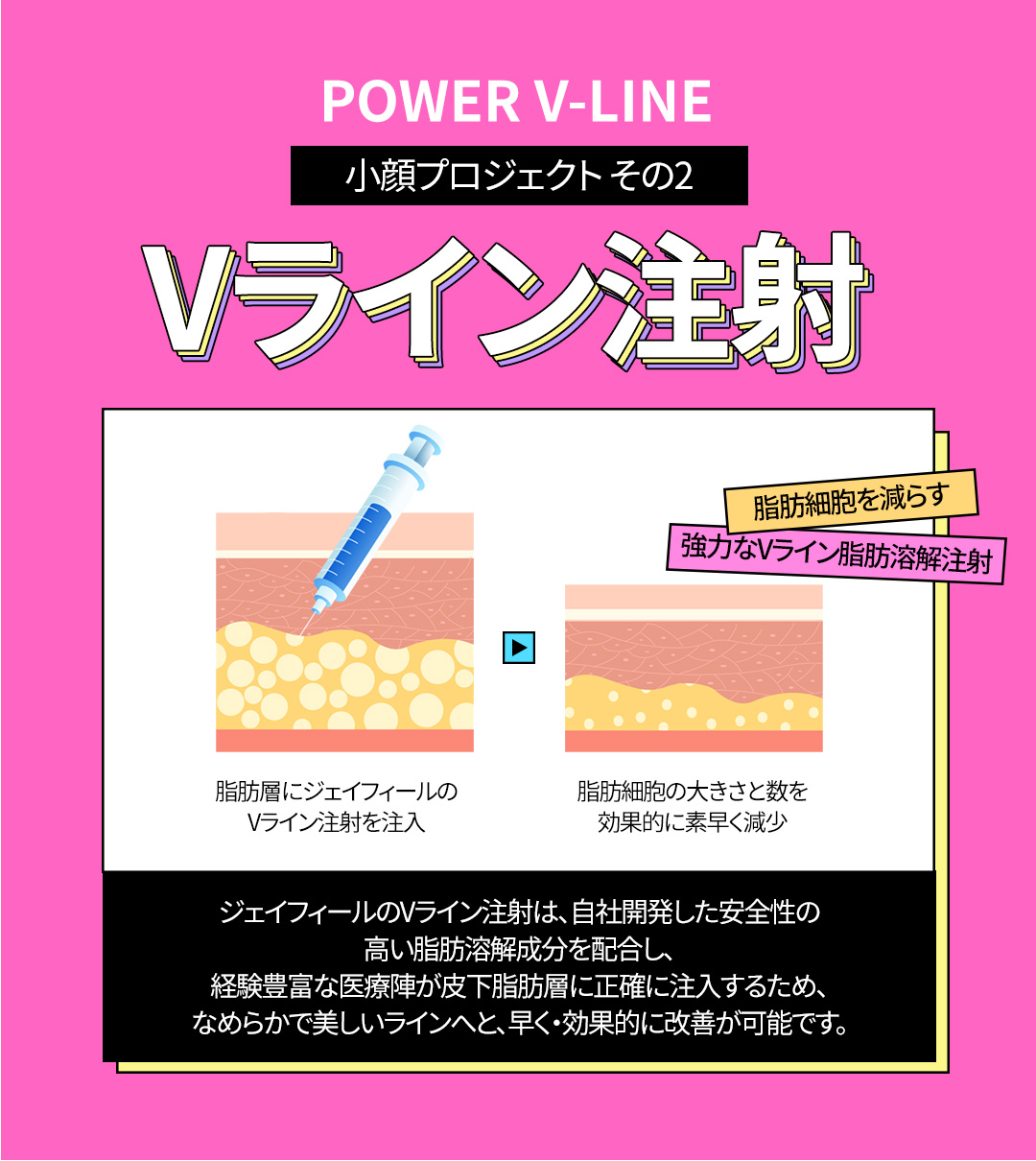 V-line HIFU mặt nhỏ Gangnam Jfeel Clinic | Đường viền mặt lý tưởng kết hợp tiêm tan mỡ [8.553 yên]