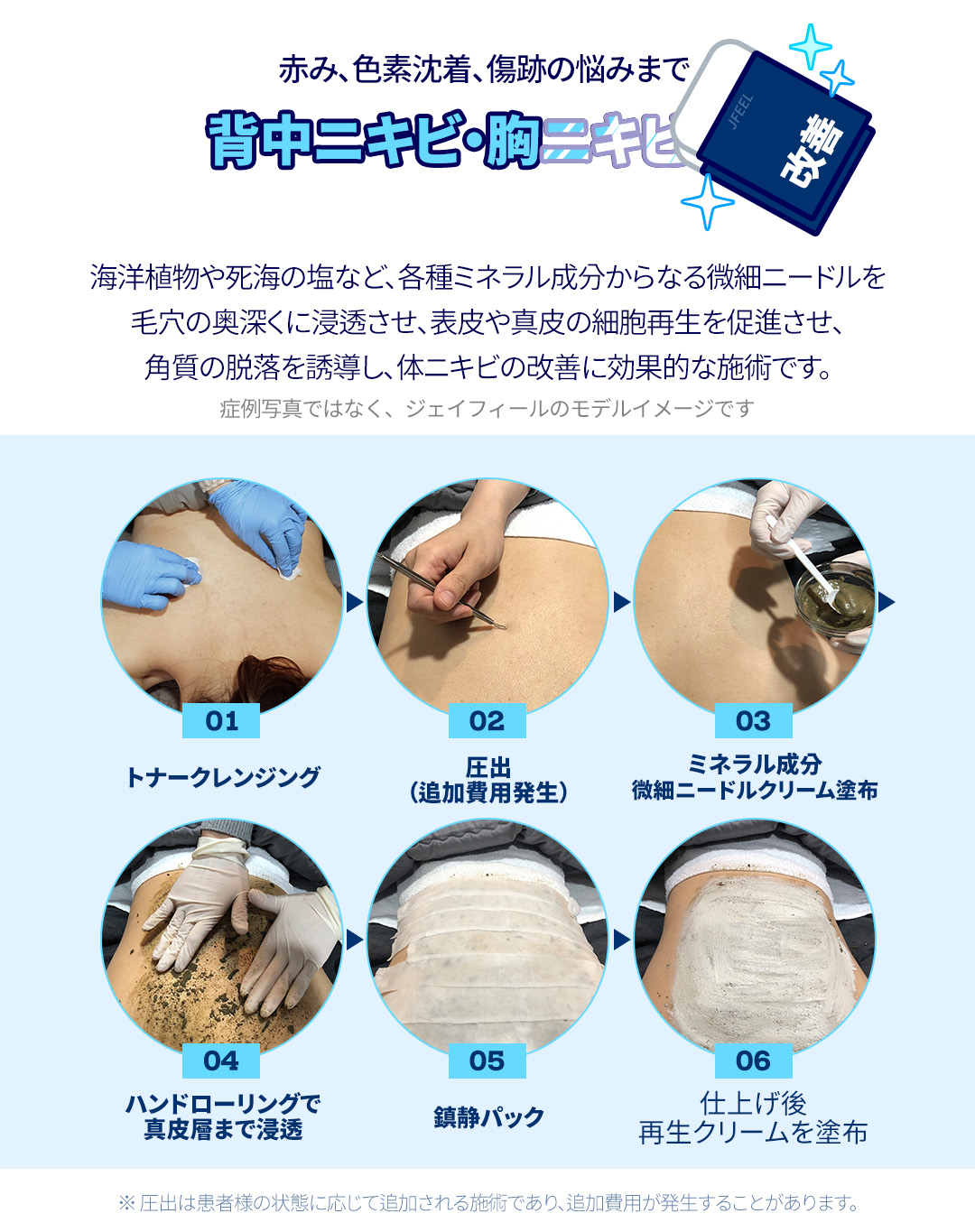 Chuyên điều trị mụn・chăm sóc theo đơn đặt hàng theo nguyên nhân | Agnes laser・PDT・peel | Seoul Gangnam stn.・Phòng khám Jfeel chi nhánh Gangnam