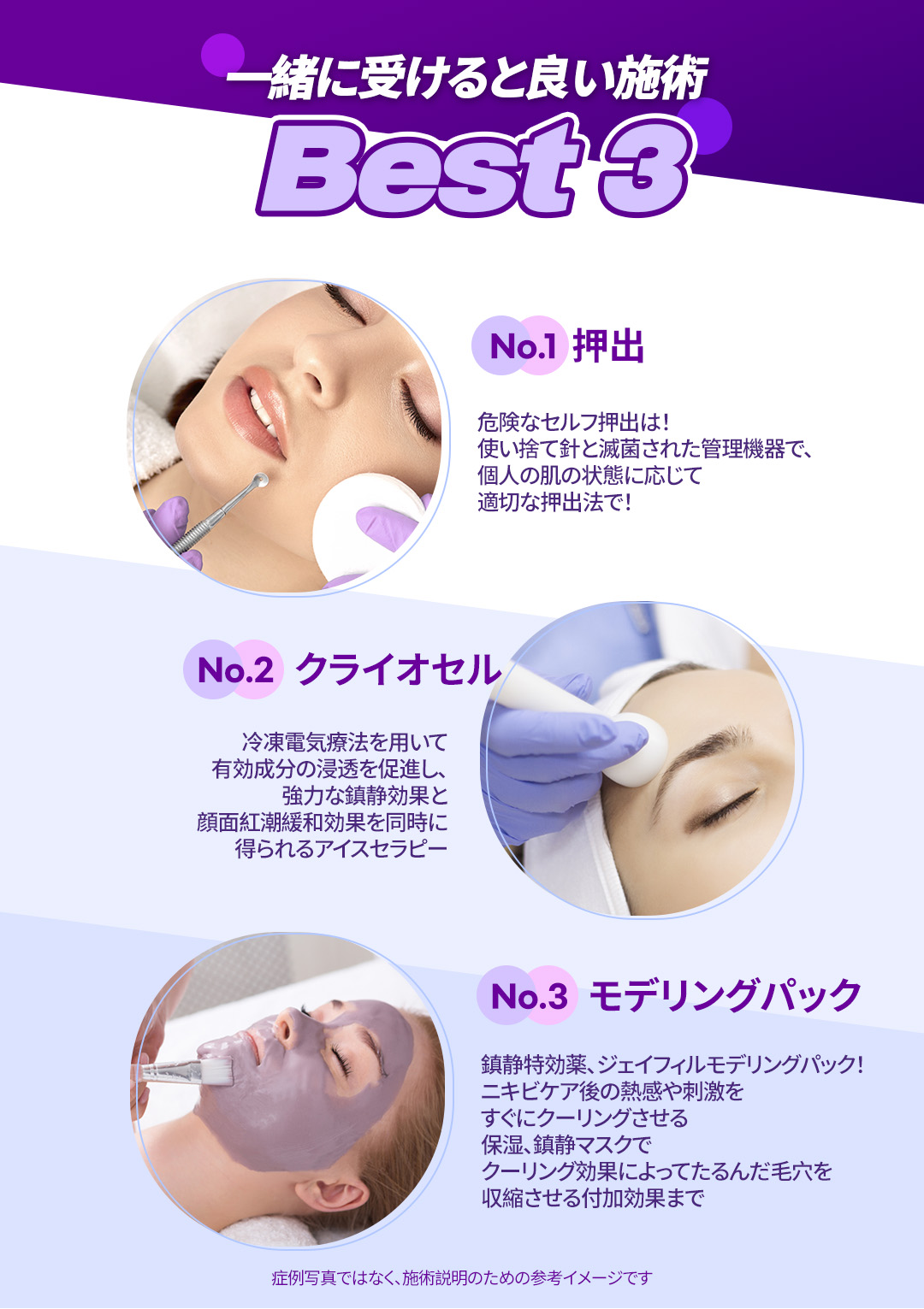 Chuyên điều trị mụn・chăm sóc theo đơn đặt hàng theo nguyên nhân | Agnes laser・PDT・peel | Seoul Gangnam stn.・Phòng khám Jfeel chi nhánh Gangnam