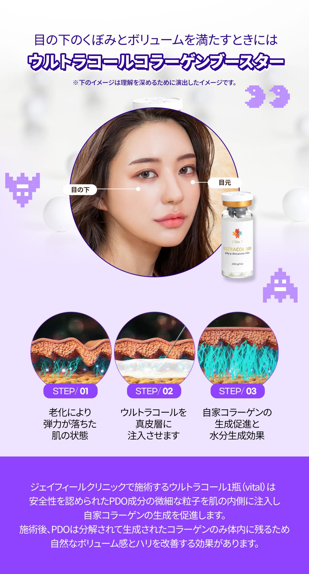 Cải thiện quầng thâm・mỡ dưới mắt Laser sóng cao tần + Filler Collagen hướng tới vùng mắt trẻ trung | Gangnam Jfeel Clinic