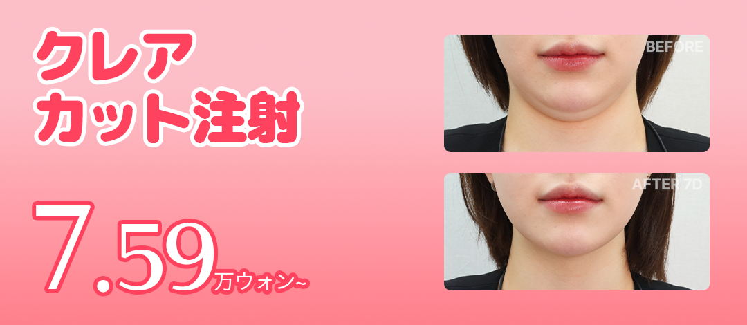 Tiêm Clair Cut hỗ trợ giảm mỡ cục bộ | Tiêm tan mỡ không steroid | Claire Thẩm mỹ Ngoại khoa trước ga Gangnam