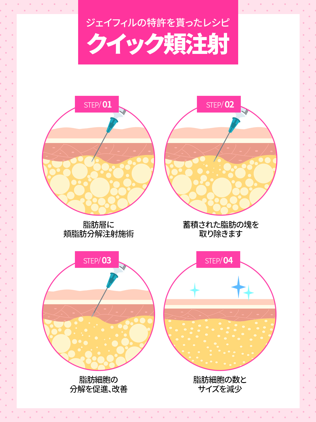 Tiêm phân giải mỡ má tạo đường mặt nhỏ | Công thức không steroid | J Feel Gangnam