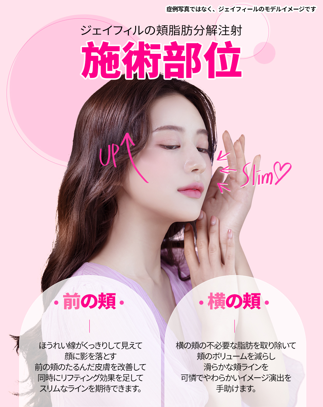 Tiêm phân giải mỡ má tạo đường mặt nhỏ | Công thức không steroid | J Feel Gangnam