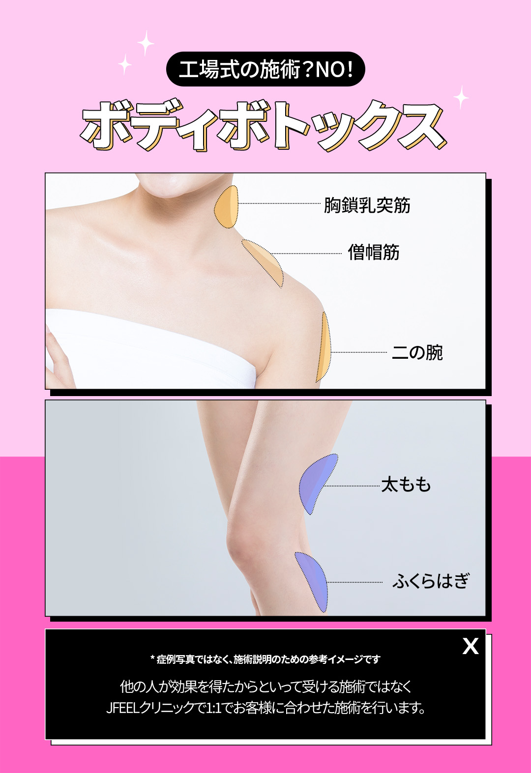 【Ga Gangnam】Thủ thuật Botox tại J Feel Clinic | Sử dụng hàng chính hãng - Menu phong phú hàm, da, đa mồ hôi