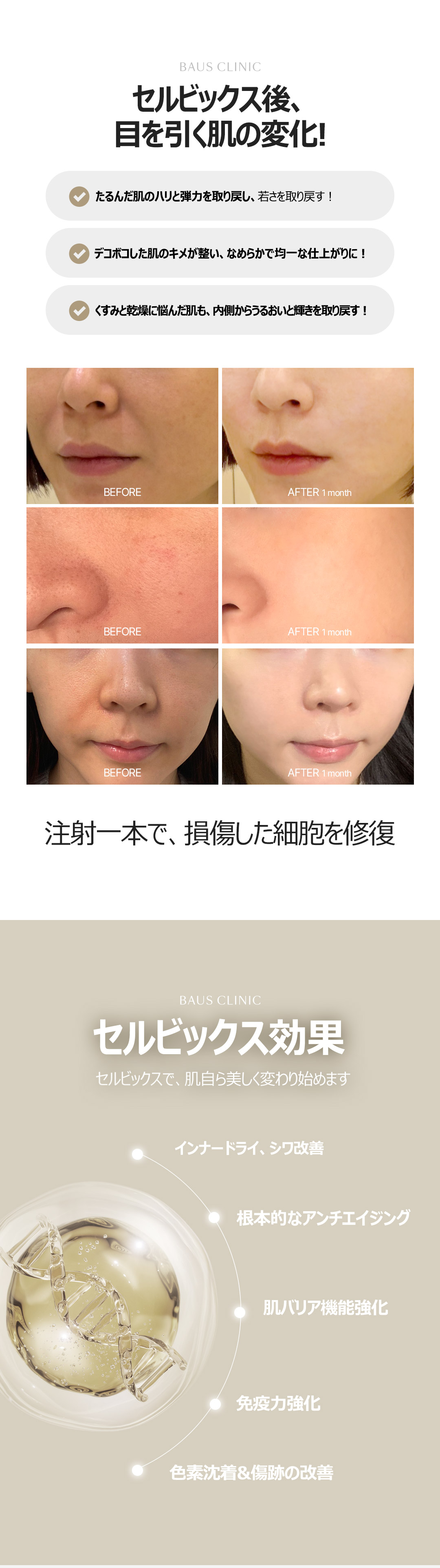 Tiêm Celvix tế bào gốc tự thân 20cc Cải thiện sắc tố, sẹo, tăng miễn dịch, tăng cường chức năng hàng rào bảo vệ, chống lão hóa da_Skin Booster kỳ vọng hiệu quả tái tạo