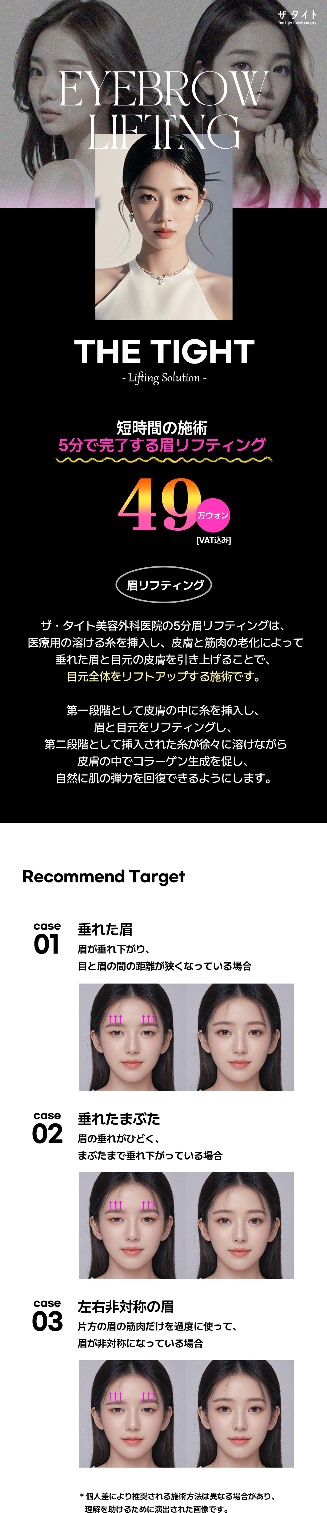 Eyebrow Lifting 5 phút (Chỉ nâng cơ) hướng đến cải thiện lông mày xệ và vùng mắt | The Tight Clinic Gangnam Seoul