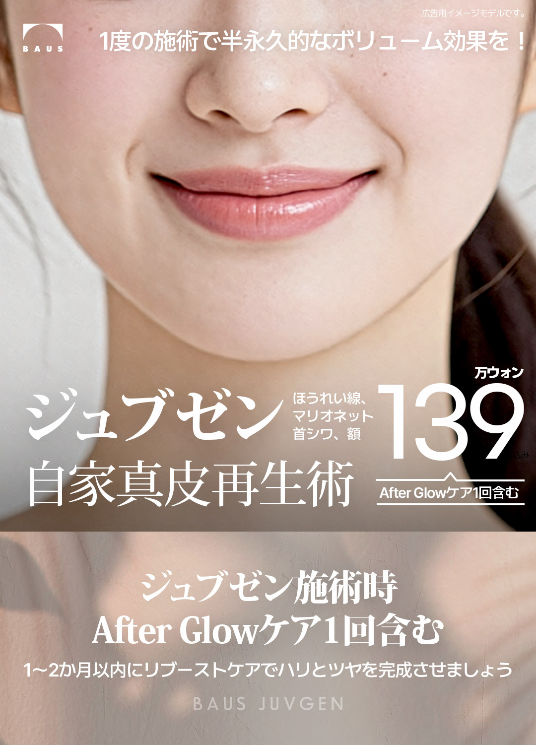 Hiệu quả bán vĩnh viễn - Phẫu thuật tái tạo chân bì tự thân Jubzen_Hiệu quả căng, tăng volume, tạo collagen_Làn da trẻ trung khỏe mạnh bằng mô của chính mình_Áp dụng cho nếp nhăn rãnh mũi miệng, trán, cổ