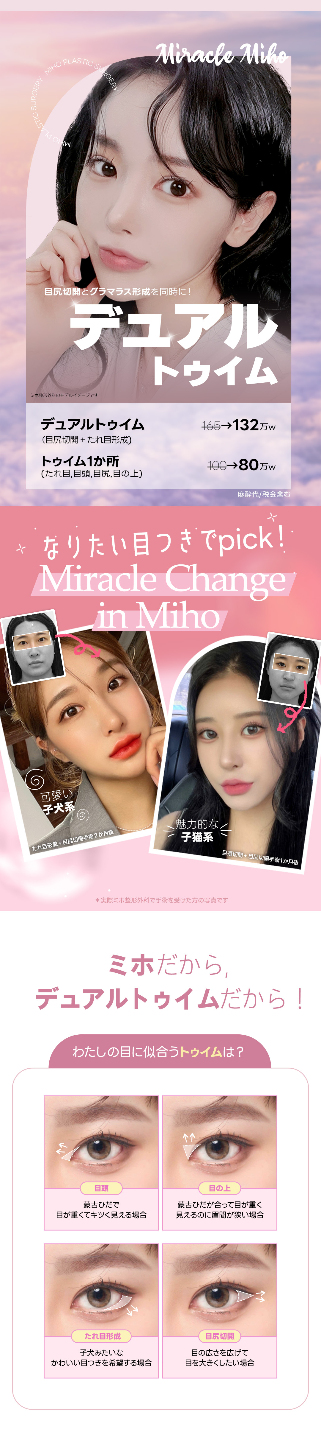 Dual Teuim cắt đuôi mắt + Tạo mắt cụp | Hướng tới đôi mắt kiểu chó con・mèo con | Phòng khám Miho Thẩm mỹ