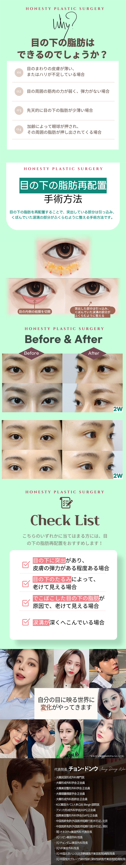 Ura Hamura (tái phân bổ mỡ dưới mắt) cải thiện quầng thâm, chảy xệ và rãnh lệ｜Honesty Plastic Surgery・Seoul Sinsa