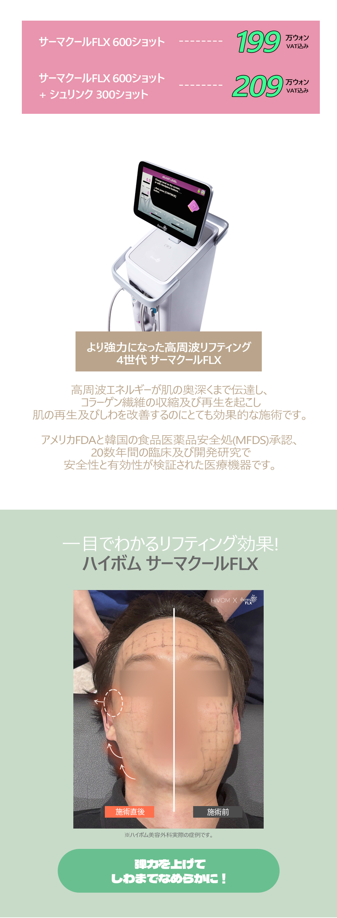 Thermage FLX 600 Shot｜Thủ thuật nâng cơ hướng đến tái tạo collagen trong 1 lần｜Viện thẩm mỹ Hibom