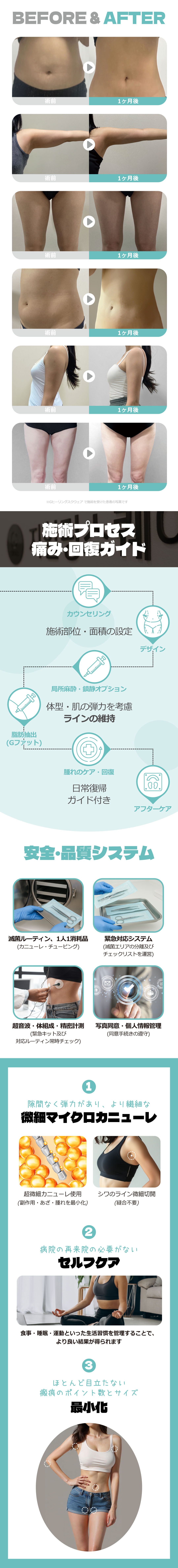 Tiêm hút mỡ G Fat | Không giới hạn dung lượng, có thể trở lại trong ngày | G Healing Square Clinic Sinsa, Seoul