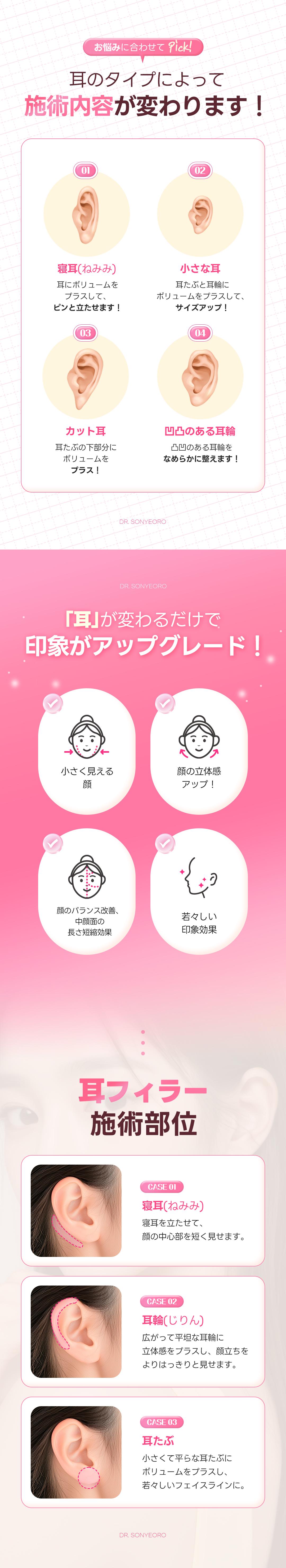 Hướng đến hiệu quả mặt nhỏ với filler tai | Kết nối trực tiếp ga Apgujeong - Dr. Sonyoro Phòng khám【550,000 won không phí phát sinh】