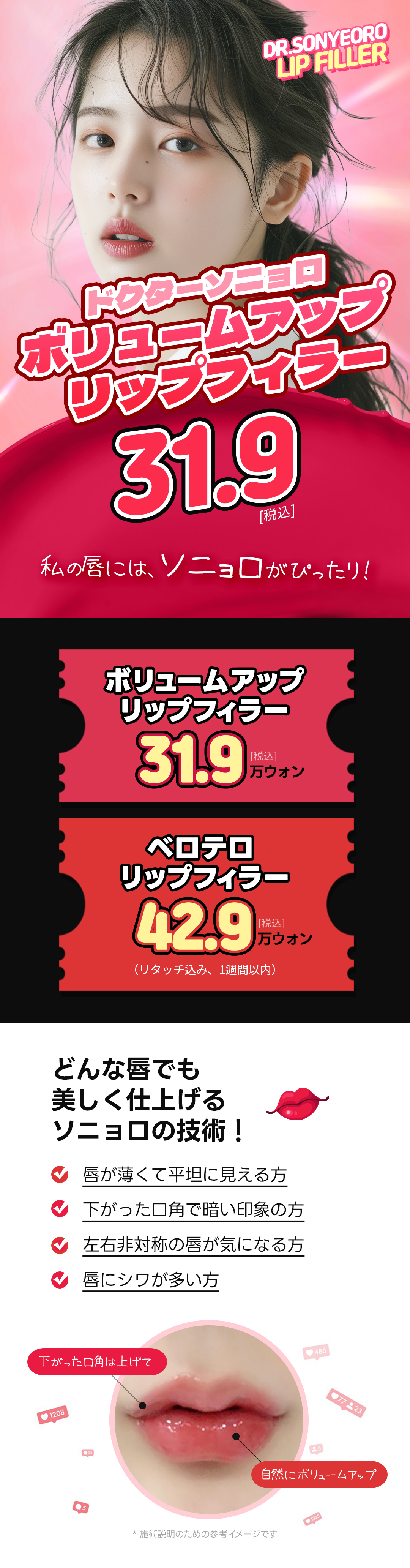 Filler môi Hàn Quốc｜Hướng đến môi lý tưởng với thiết kế tùy chỉnh cá nhân｜Phòng khám Doctor Sonyeoro Gangnam Apgujeong