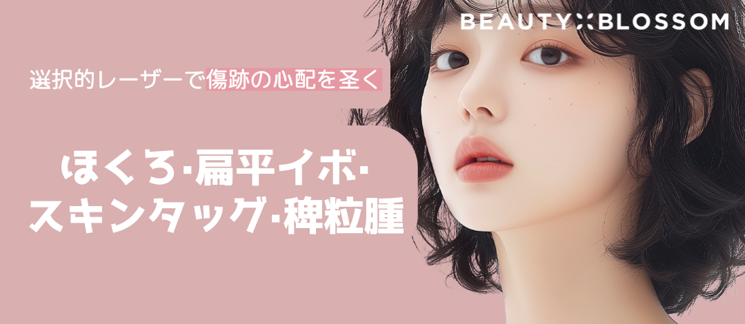 Loại bỏ nốt ruồi, mụn cóc phẳng, mụn thịt, mụn kê bằng laser | Phương pháp điều trị chú ý đến gánh nặng cho da xung quanh