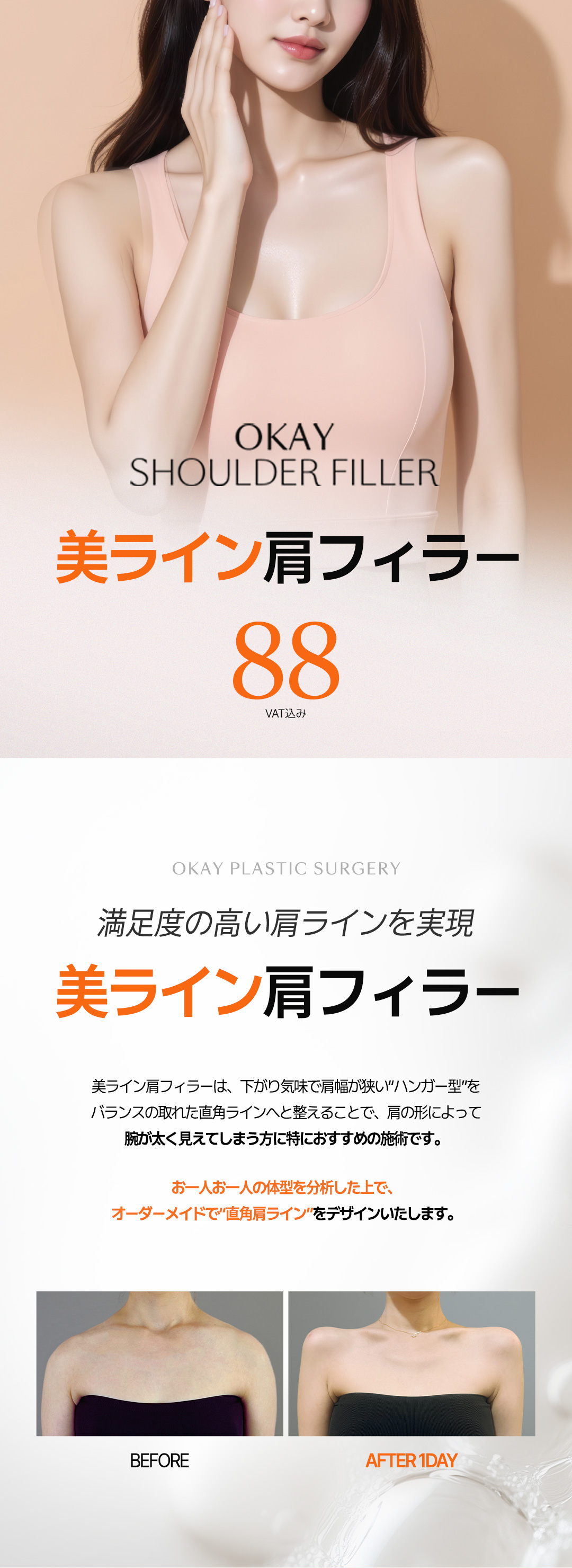 Hướng đến vai vuông với tiêm filler vai | Filler vai đường đẹp | OK Phòng khám Seoul ga Cheongdam