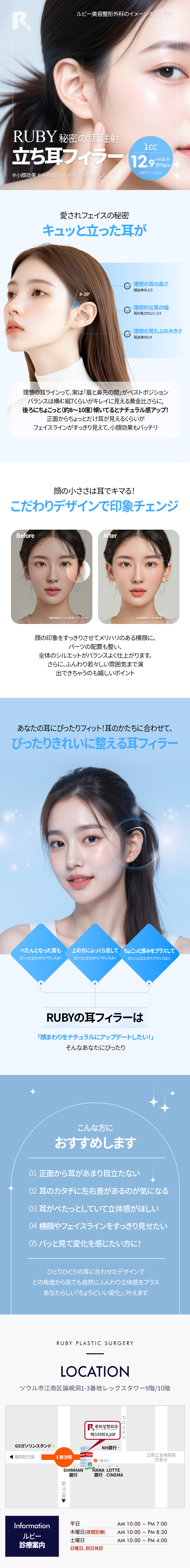 Filler tai (tạo tai vểnh) hướng đến ấn tượng mặt nhỏ｜Thủ thuật 5 phút・giảm thời gian phục hồi｜Phẫu thuật Thẩm mỹ Ruby ga Sinsa Seoul