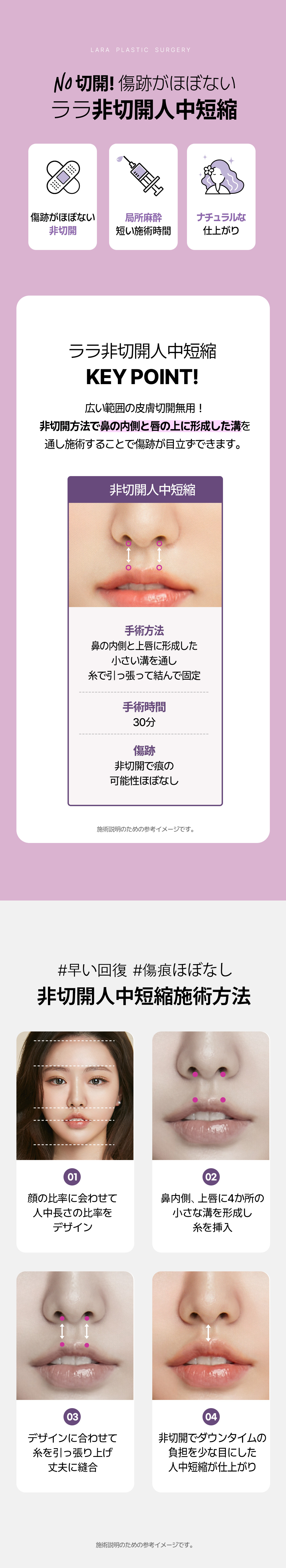 【Không rạch】Thay đổi ấn tượng với liệu pháp rút ngắn nhân trung | Lara Thẩm mỹ Viện (Hàn Quốc・Gangnam)