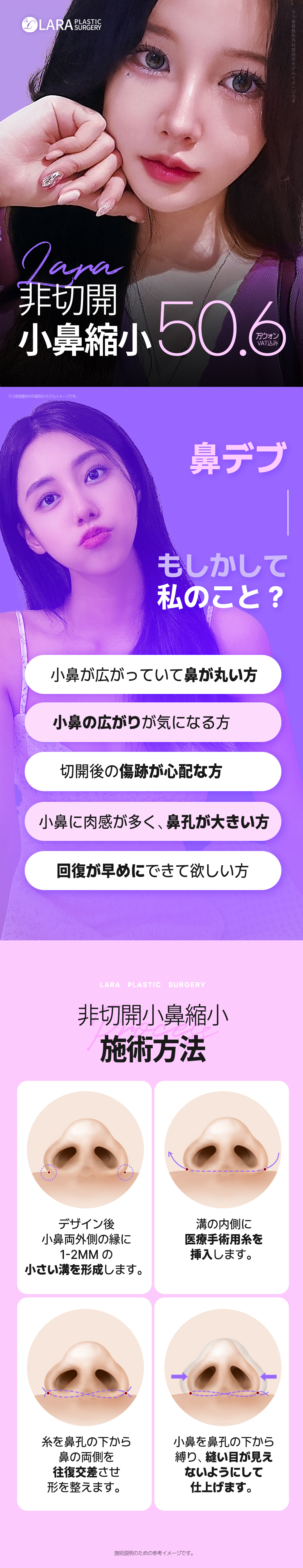 Thu nhỏ cánh mũi không cắt | Thu nhỏ cánh mũi bằng chỉ sẹo khó thấy | Lala Thẩm mỹ Gangnam Seoul