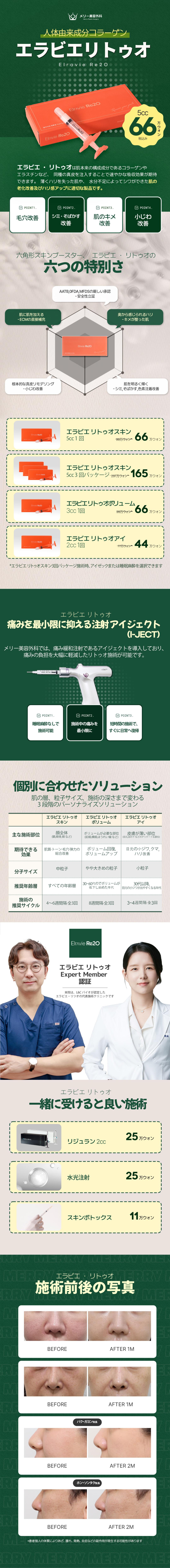 Elravie Re2O 5cc｜Skin Booster với collagen nguồn gốc người hướng đến cải thiện lỗ chân lông・nếp nhăn nhỏ・độ căng｜Merry Phẫu thuật Thẩm mỹ Apgujeong Seoul