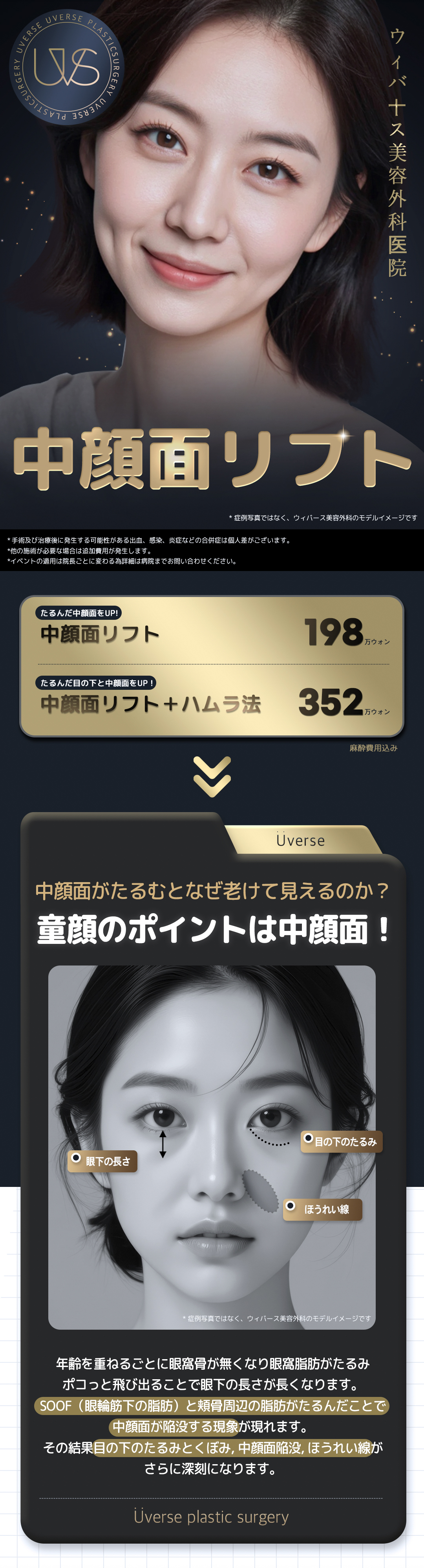 Căng da giữa mặt｜Cải thiện chảy xệ, rãnh lệ｜Phẫu thuật thẩm mỹ Hàn Quốc tại Viện thẩm mỹ Webers