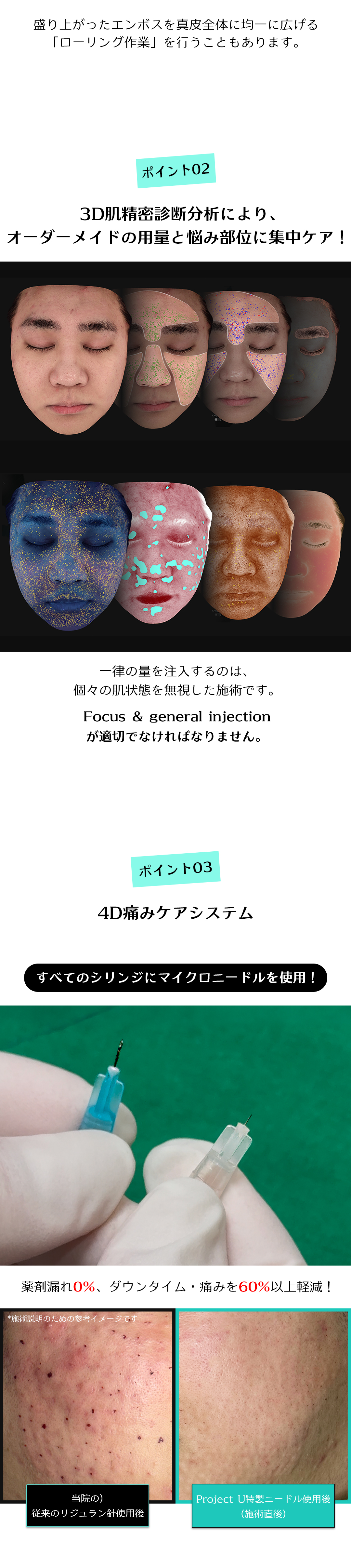 Rejuran Healer là gì? Đặc điểm và lưu ý về phương pháp Skin Booster đang hot tại Hàn Quốc