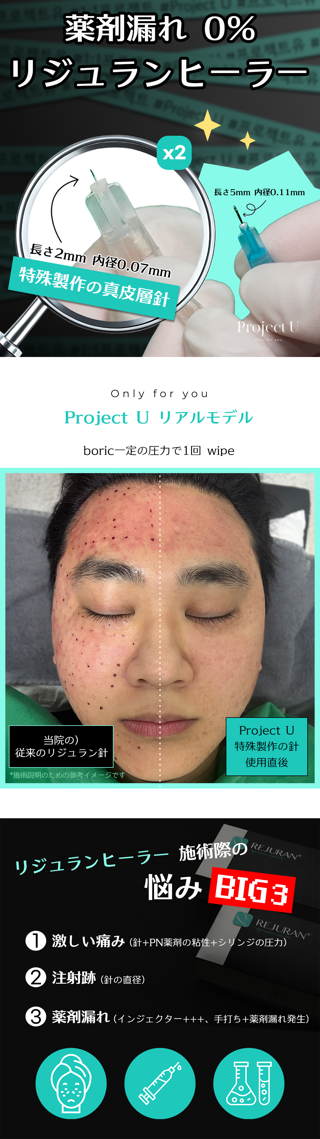 Rejuran Healer là gì? Đặc điểm và lưu ý về phương pháp Skin Booster đang hot tại Hàn Quốc