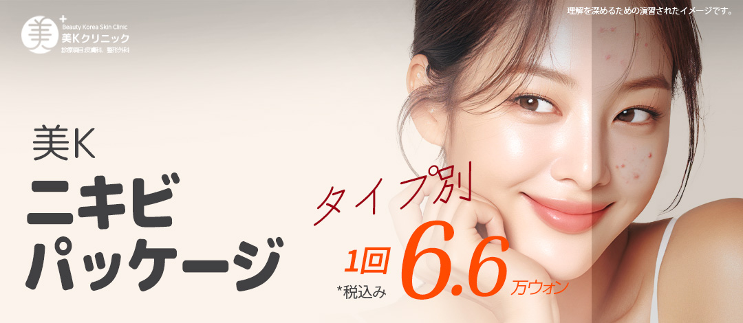 Gói chăm sóc mụn・lỗ chân lông | Aqua Peel × Laser Toning × Fraxel | Phòng khám Mikei ga Gangnam Seoul