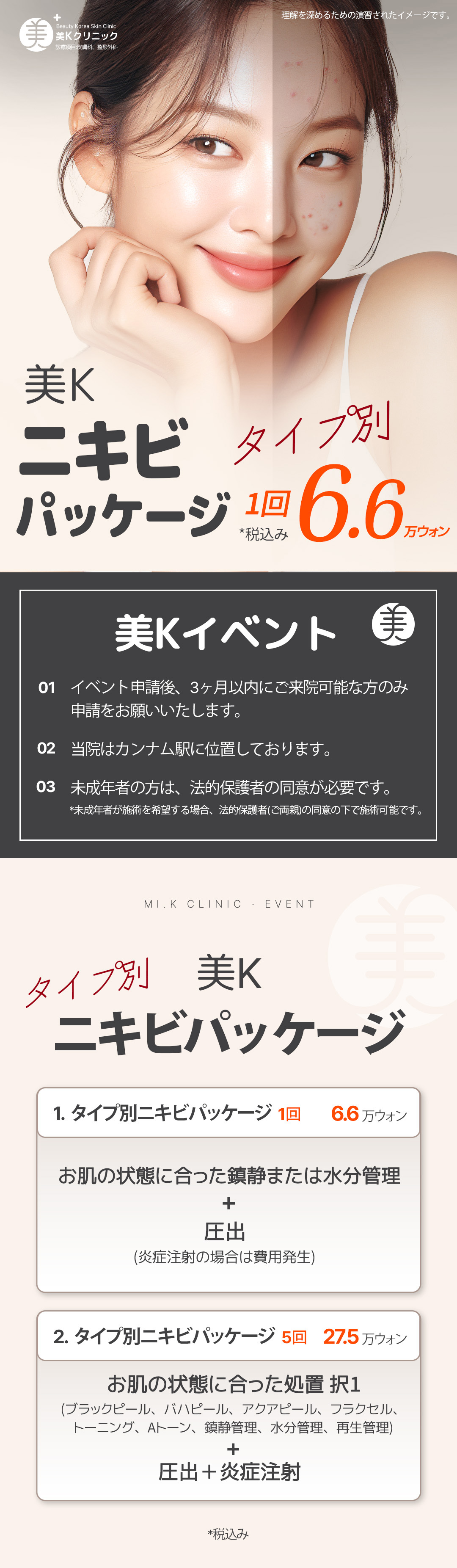 Gói chăm sóc mụn・lỗ chân lông | Aqua Peel × Laser Toning × Fraxel | Phòng khám Mikei ga Gangnam Seoul