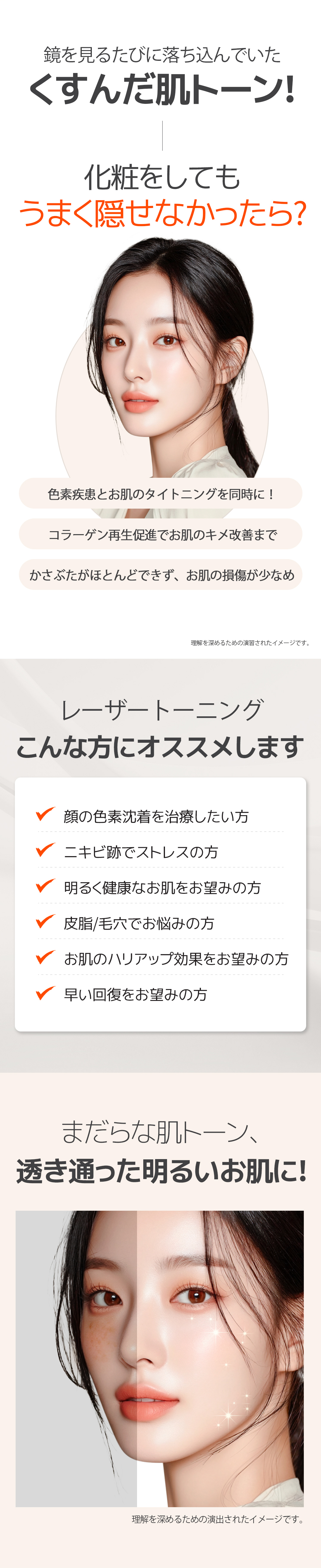 Gói chăm sóc mụn・lỗ chân lông | Aqua Peel × Laser Toning × Fraxel | Phòng khám Mikei ga Gangnam Seoul