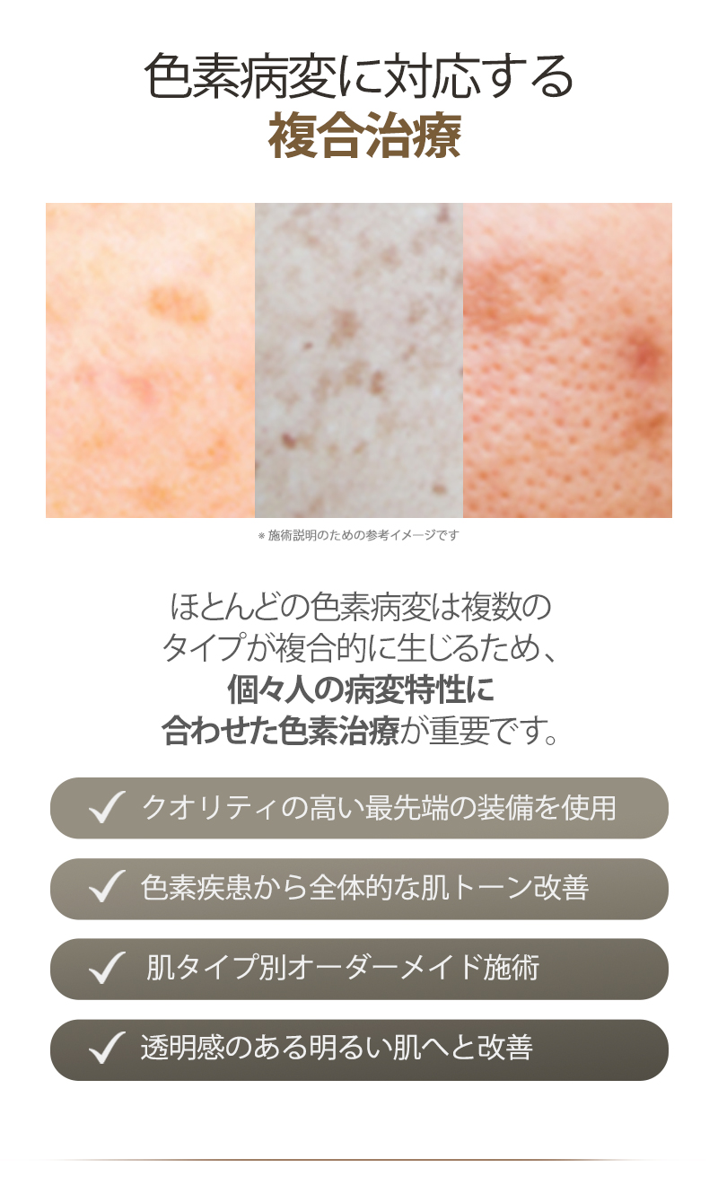 Laser xóa nám Dear