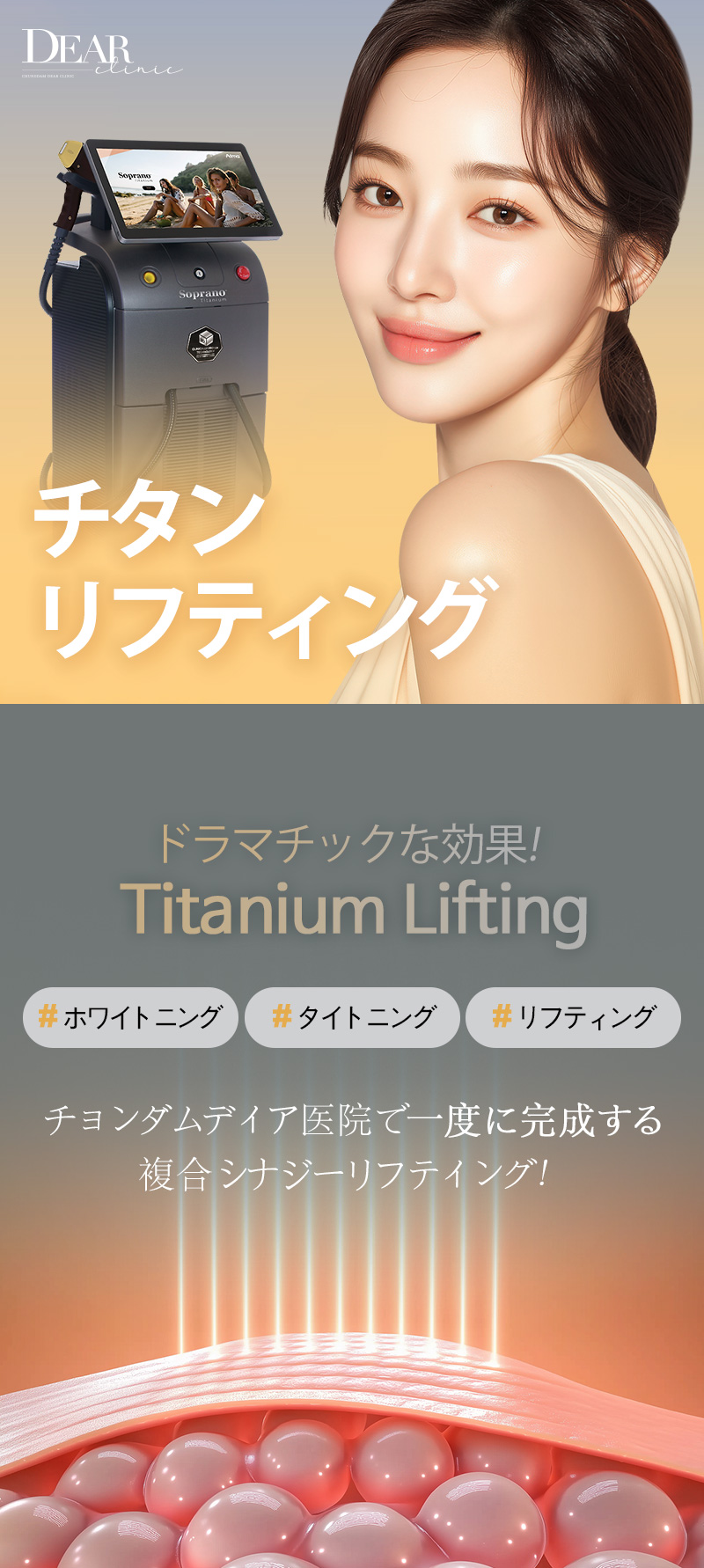 Titanium Lifting 80kj | Laser 3 bước sóng nâng cơ, trắng sáng, chăm sóc lỗ chân lông đồng thời | Phòng khám Cheongdam Dia