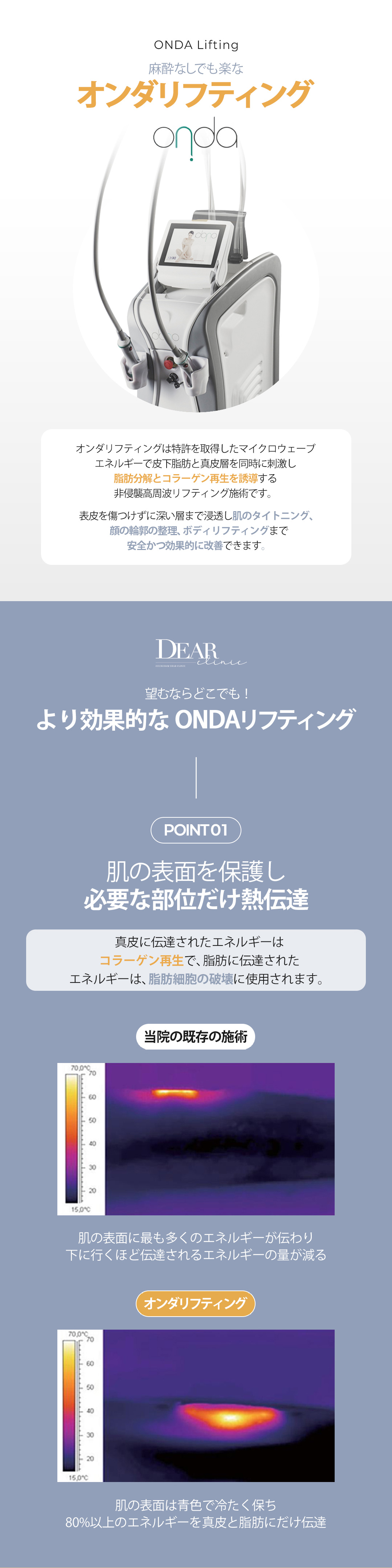 Onda Lifting 60kj | Liệu pháp nâng cơ không xâm lấn không cần gây tê | Phòng khám Cheongdam Dear