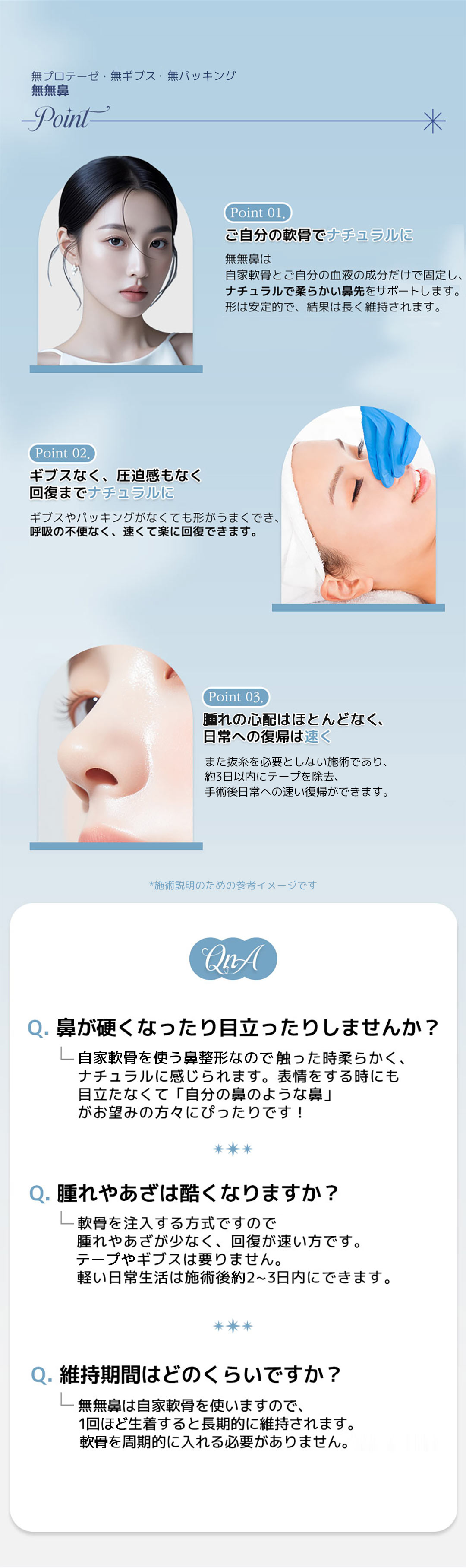 Mũi Mumu Ver.2｜Chỉnh hình mũi tự nhiên với sụn tự thân・không sử dụng silicon｜Phẫu thuật Thẩm mỹ Very Good