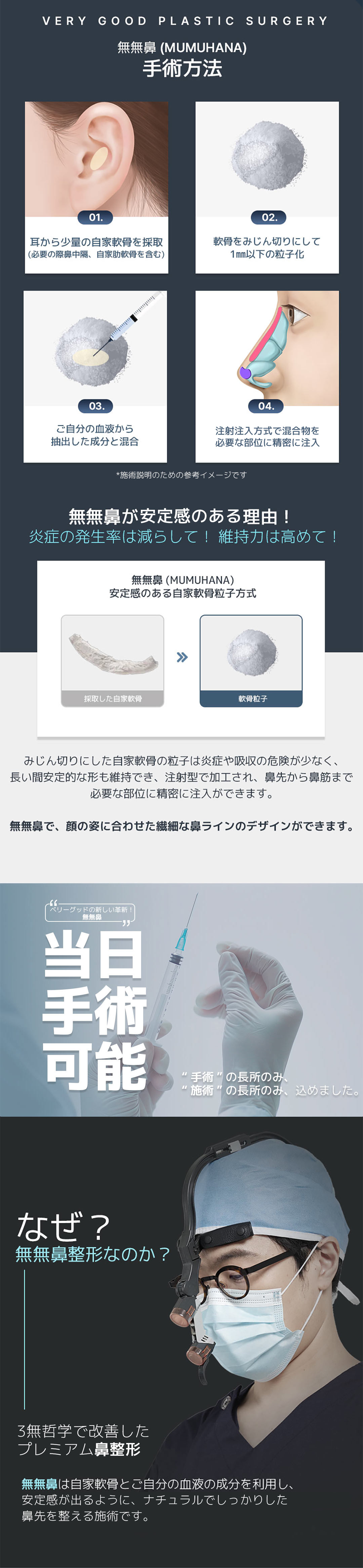 Mũi Mumu Ver.2｜Chỉnh hình mũi tự nhiên với sụn tự thân・không sử dụng silicon｜Phẫu thuật Thẩm mỹ Very Good