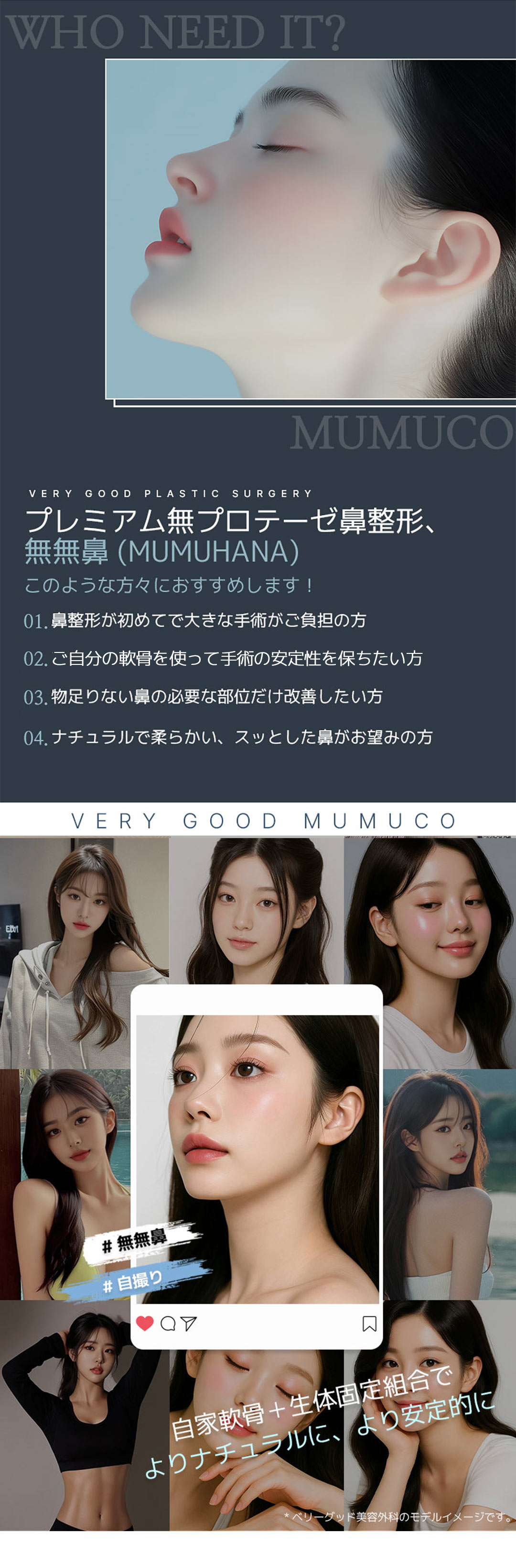 Mũi Mumu Ver.2｜Chỉnh hình mũi tự nhiên với sụn tự thân・không sử dụng silicon｜Phẫu thuật Thẩm mỹ Very Good