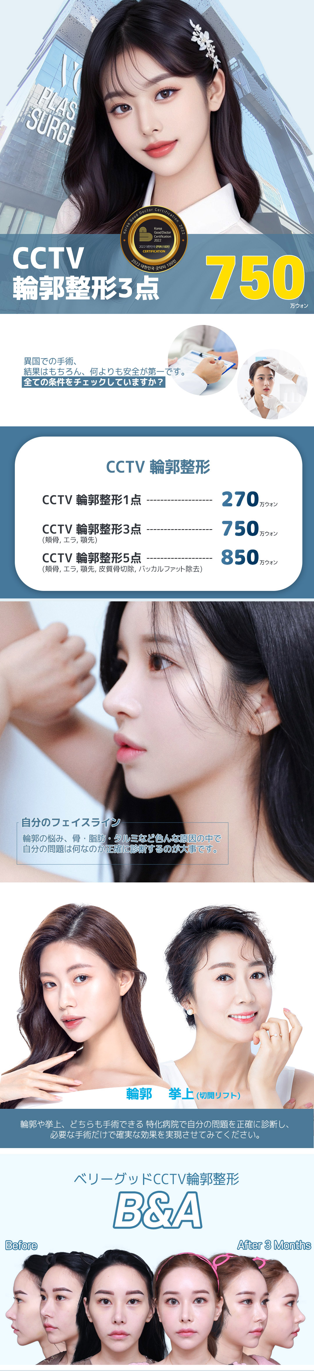 Bộ 3 điểm tạo hình đường viền CCTV (Gò má・Hàm・Cằm) Hệ thống theo dõi phẫu thuật an tâm｜Very Good Thẩm mỹ